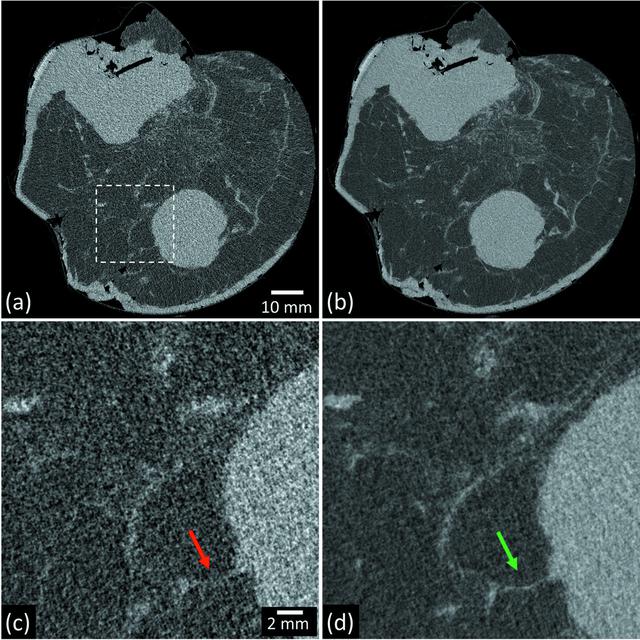 [Figure 11]