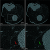 [Figure 11]