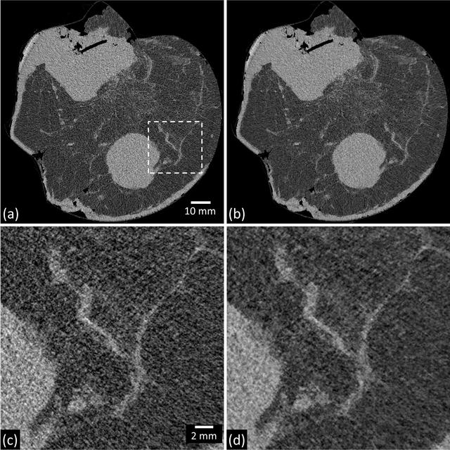 [Figure 12]